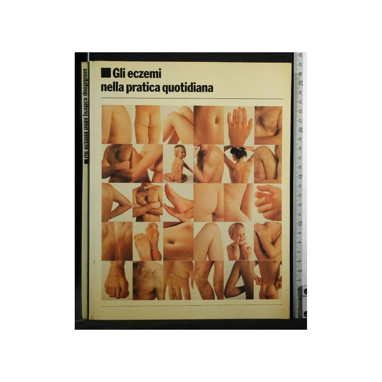 GLI ECZEMI NELLA PRATICA QUOTIDIANA
