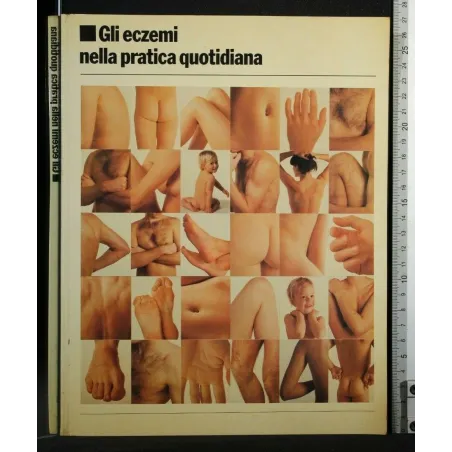 GLI ECZEMI NELLA PRATICA QUOTIDIANA
