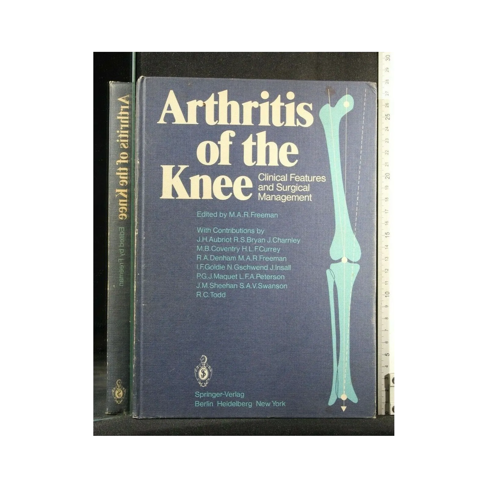 ARTHRITIS OF THE KNEE