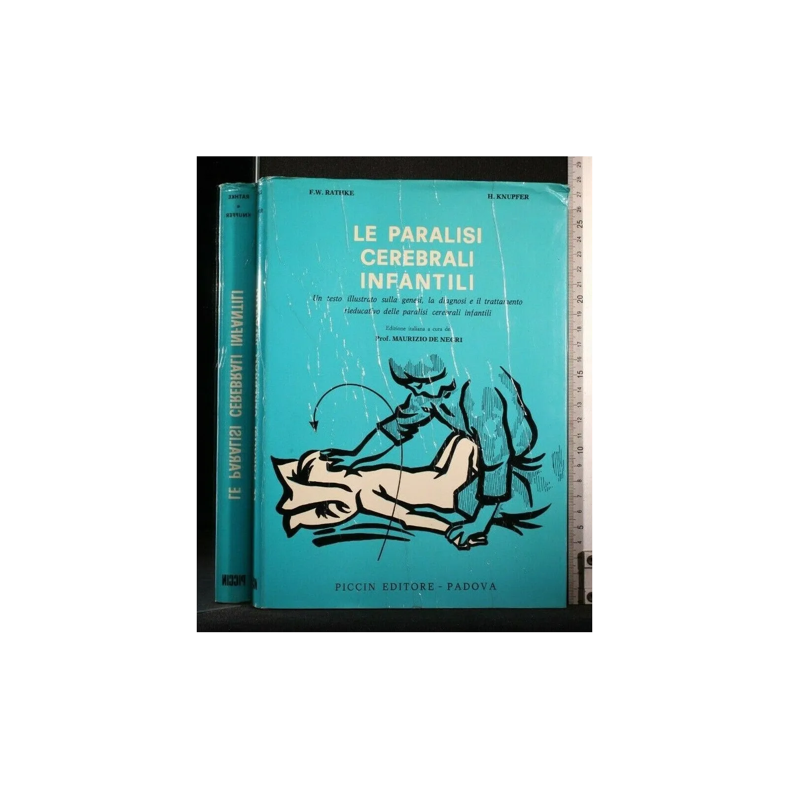 LE PARALISI CEREBRALI INFANTILI