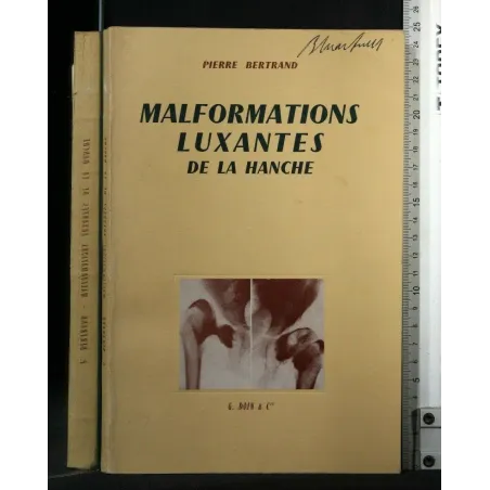 MALFORMATIONS LUXANTES DE LA HANCHE