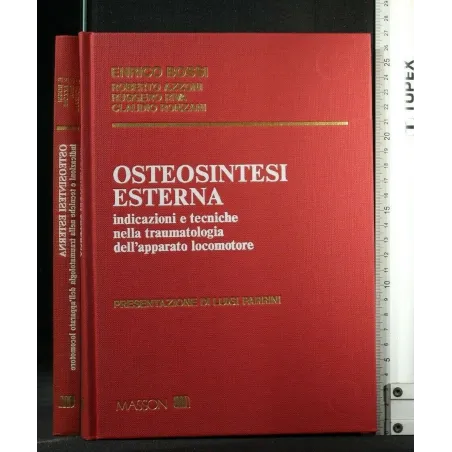 OSTEOSINTESI ESTERNA