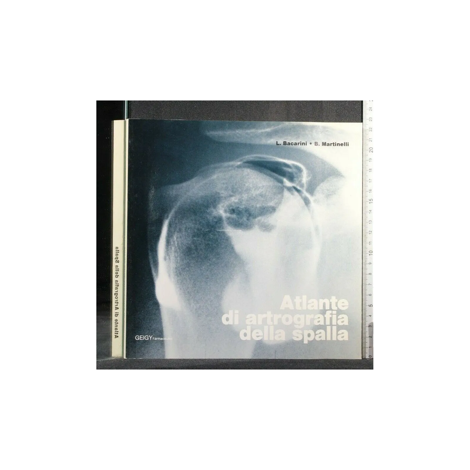 ATLANTE DI ARTROGRAFIA DELLA SPALLA