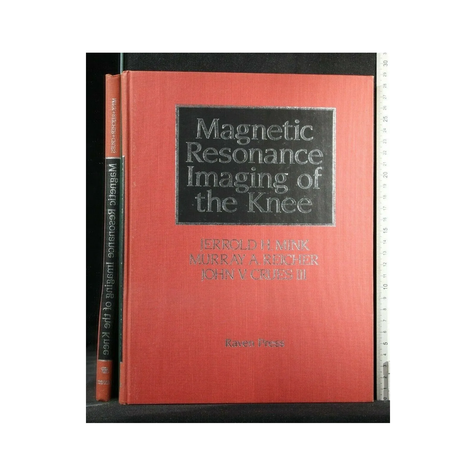 MAGNETIC RESONANCE IMAGING OF THE KNEE