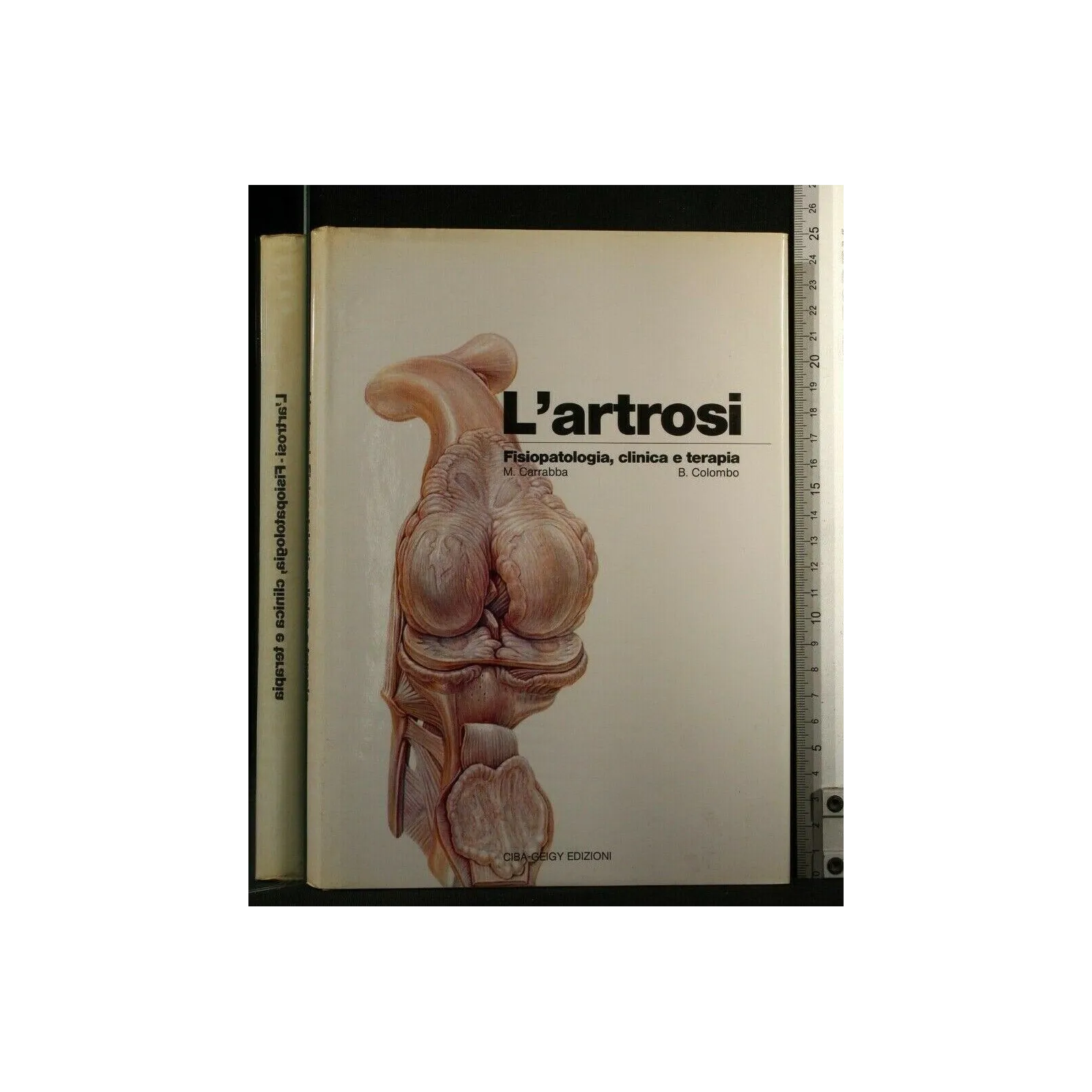L'ARTROSI FISIOPATOLOGIA, CLINICA E TERAPIA