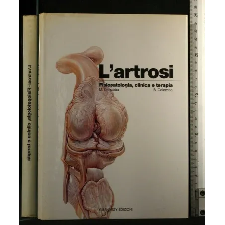 L'ARTROSI FISIOPATOLOGIA, CLINICA E TERAPIA