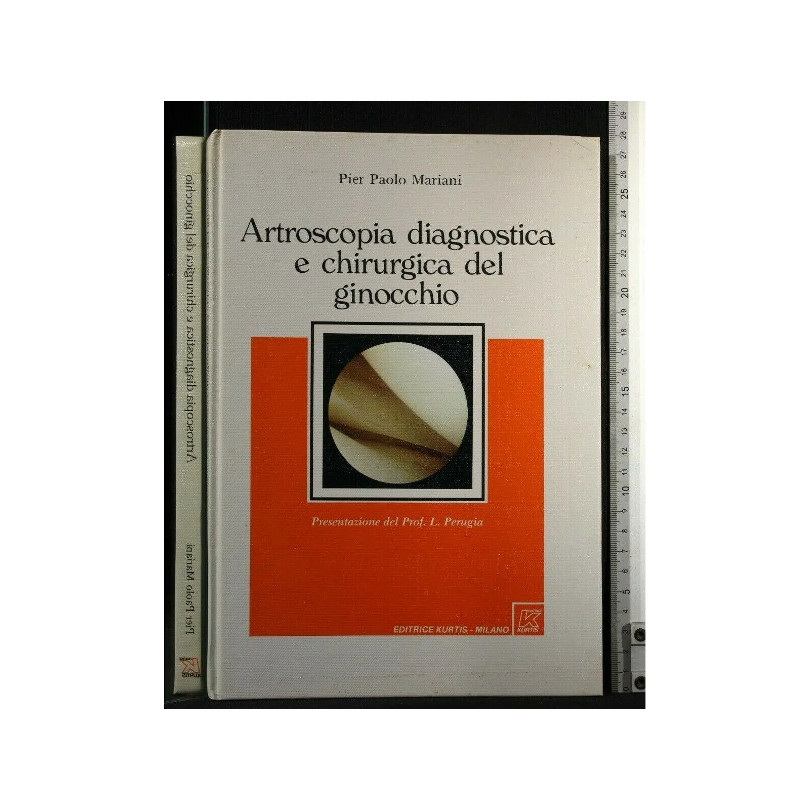 ARTROSCOPIA DISGNOSTICA E CHIRURGICA DEL GINOCCHIO