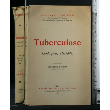 TUBERCULOSE CONTAGION, HEREDITE'