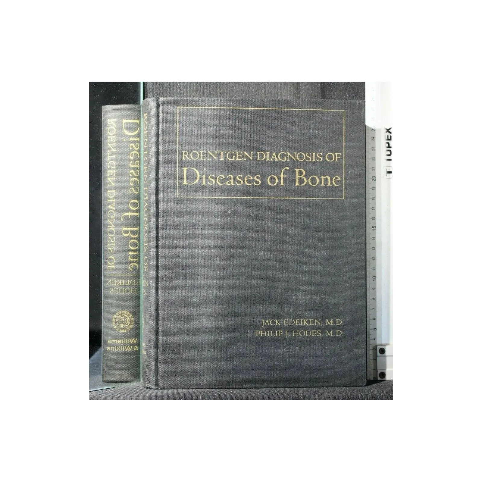ROENTGEN DIAGNOSIS OF DISEASES OF BONE