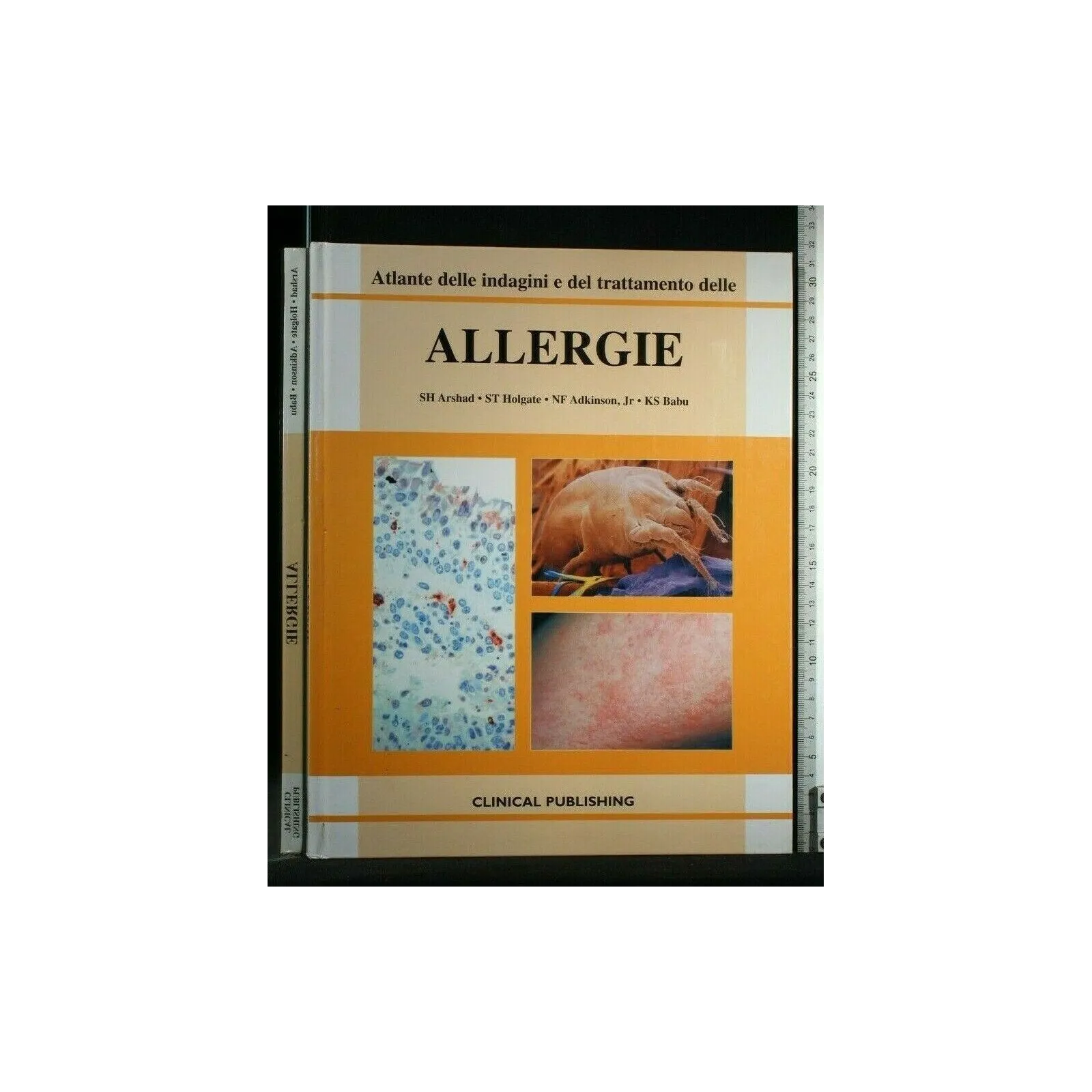 ATLANTE DELLE INDAGINI E DEL TRATTAMENTO DELLE ALLERGIE