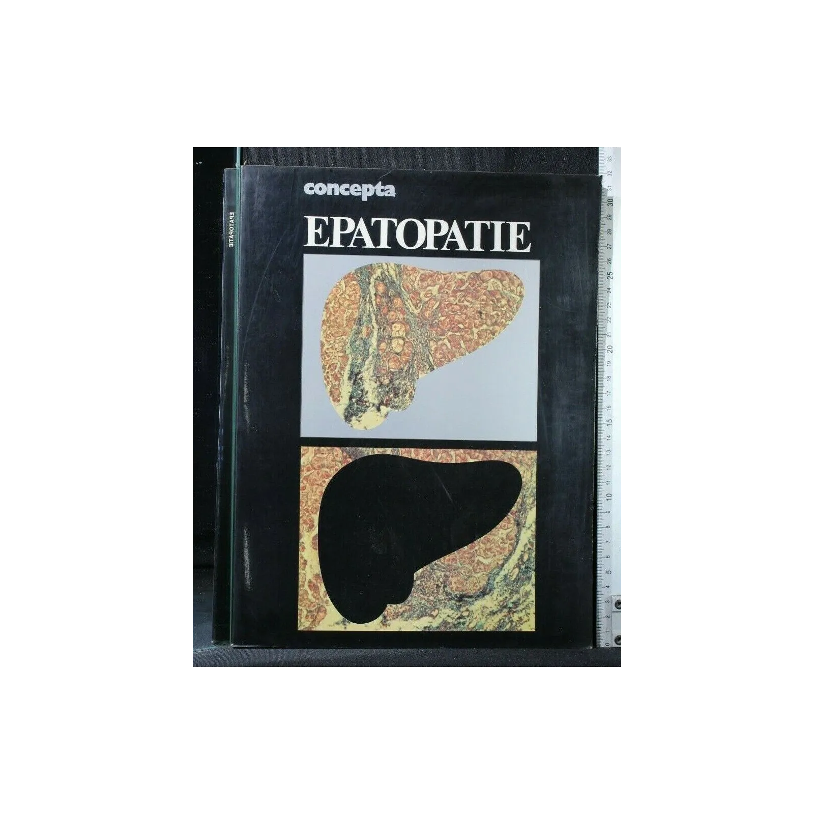 CONCEPTA EPATOPATIE