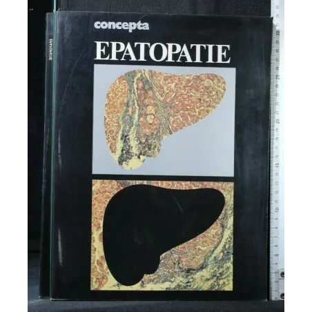 CONCEPTA EPATOPATIE
