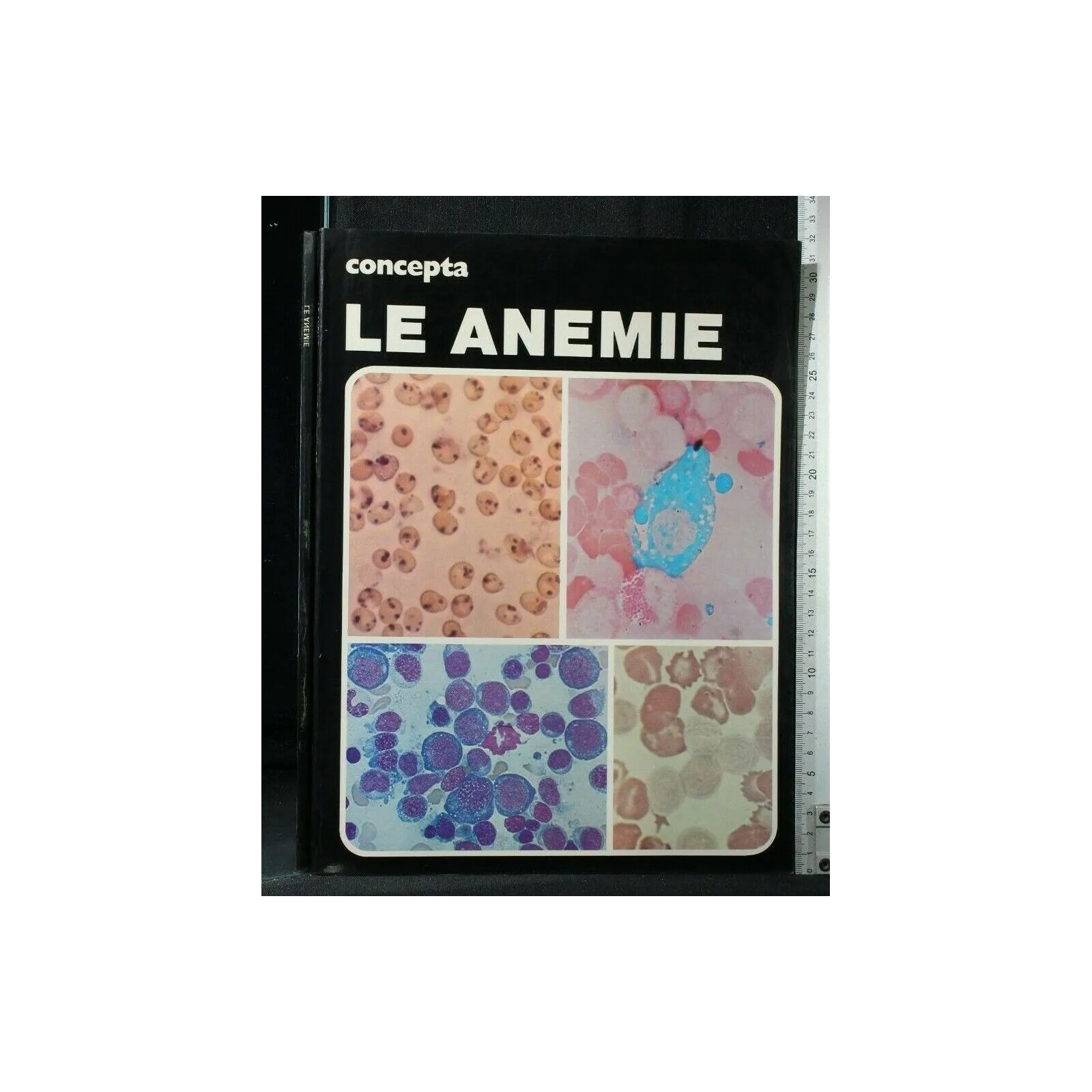 CONCEPTA LE ANEMIE