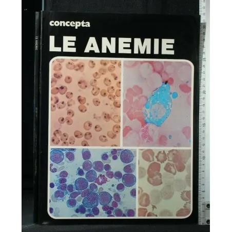 CONCEPTA LE ANEMIE