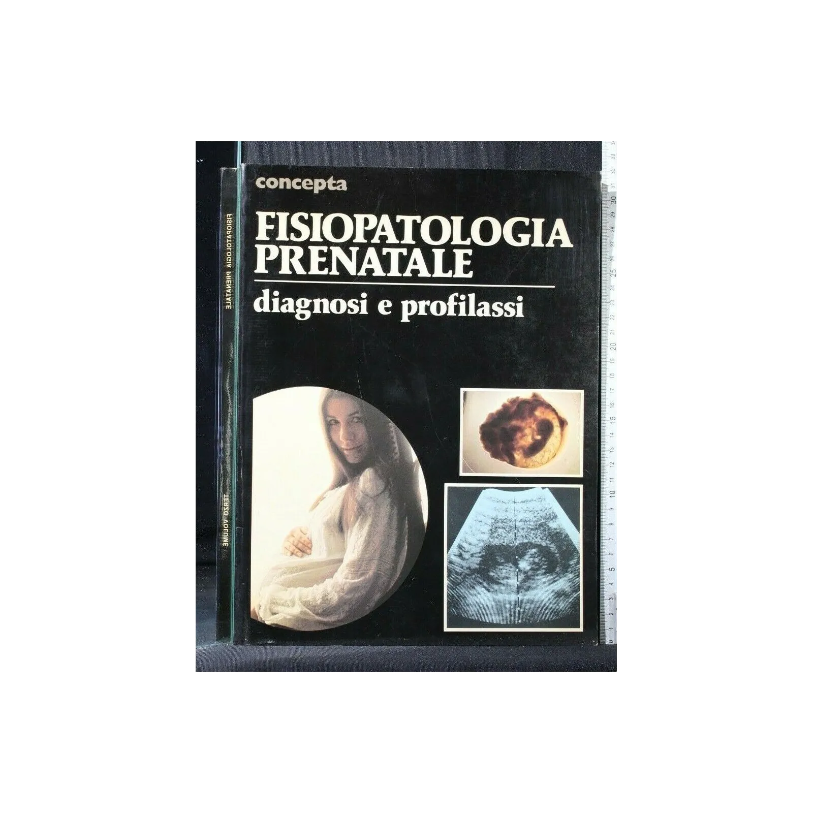 CONCEPTA FISIOPATOLOGIA PRENATALE DIAGNOSI E PROFILASSI VOLUME 3