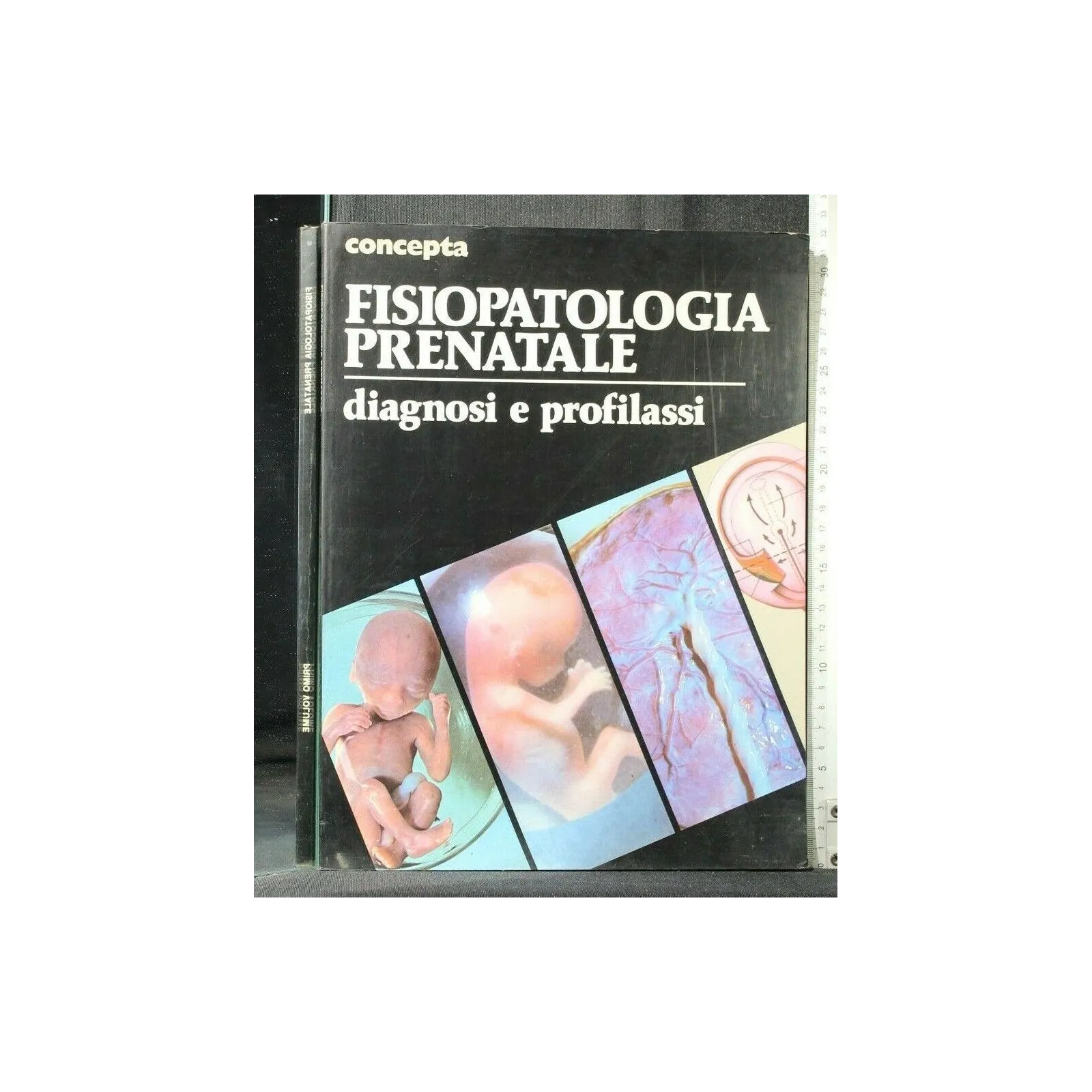 CONCEPTA FISIOPATOLOGIA PRENATALE DIAGNOSI E PROFILASSI VOLUME 1