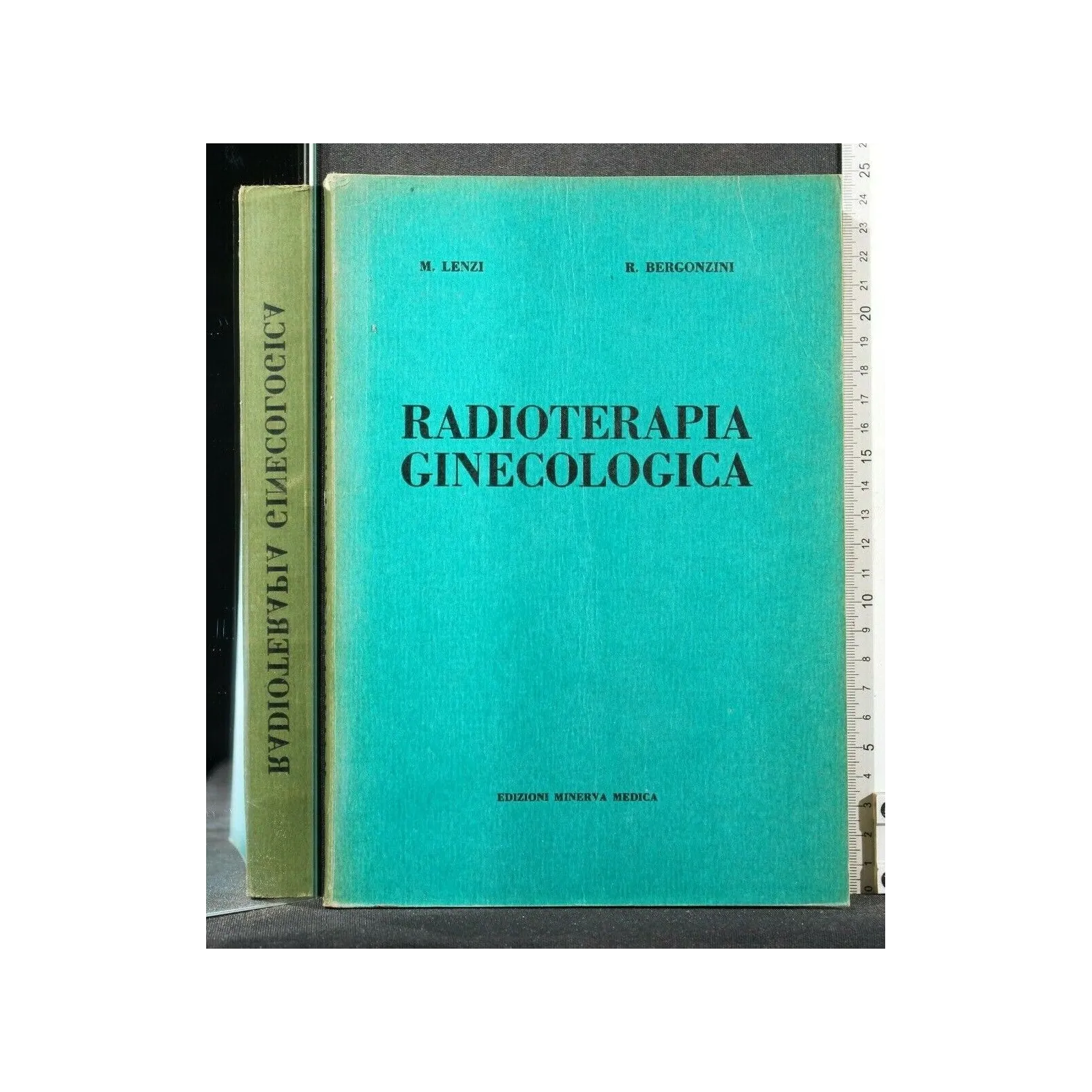 RADIOTERAPIA GINECOLOGICA
