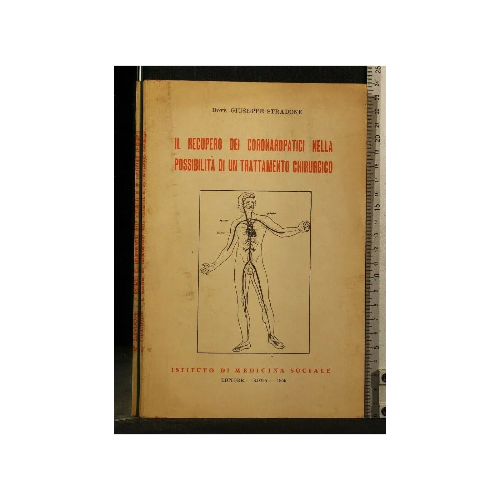IL RECUPERO DEI CORONAROPATICI NELLA POSSIBILITA' DI UN