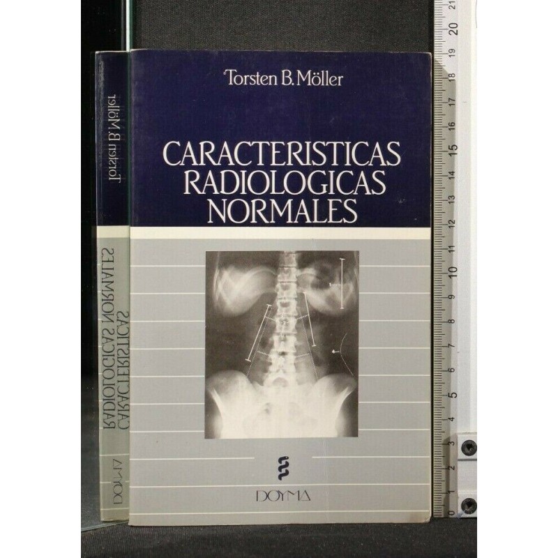 CARACTERISTICAS RADIOLOGICAS NORMALES