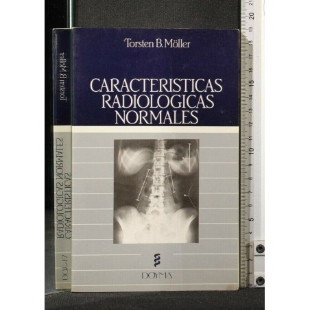 CARACTERISTICAS RADIOLOGICAS NORMALES