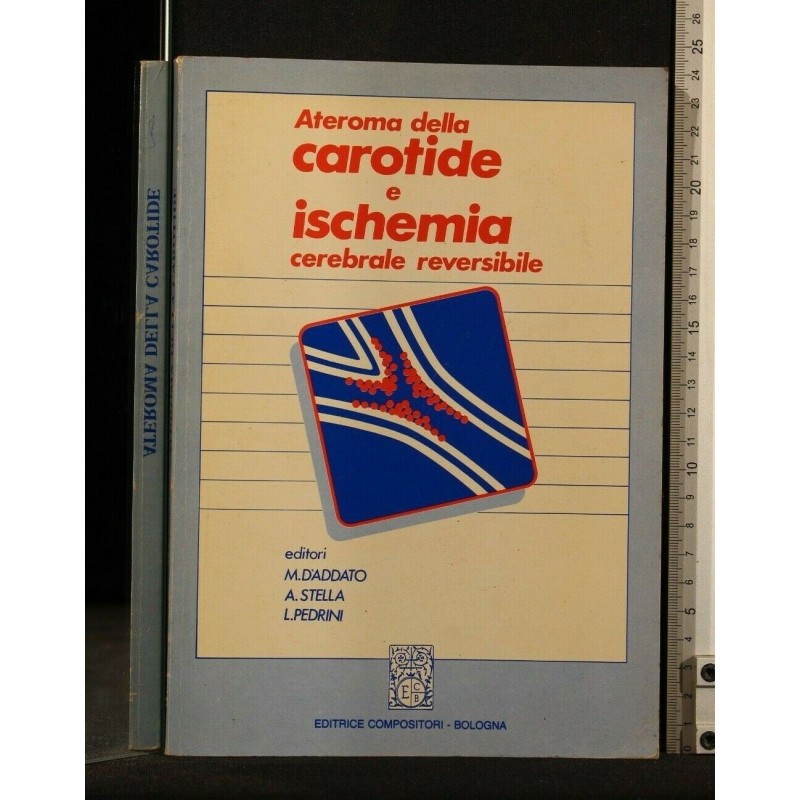 ATEROMA DELLA CAROTIDE E ISCHEMIA CEREBRALE REVERSIBILE