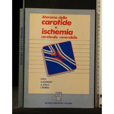 ATEROMA DELLA CAROTIDE E ISCHEMIA CEREBRALE REVERSIBILE