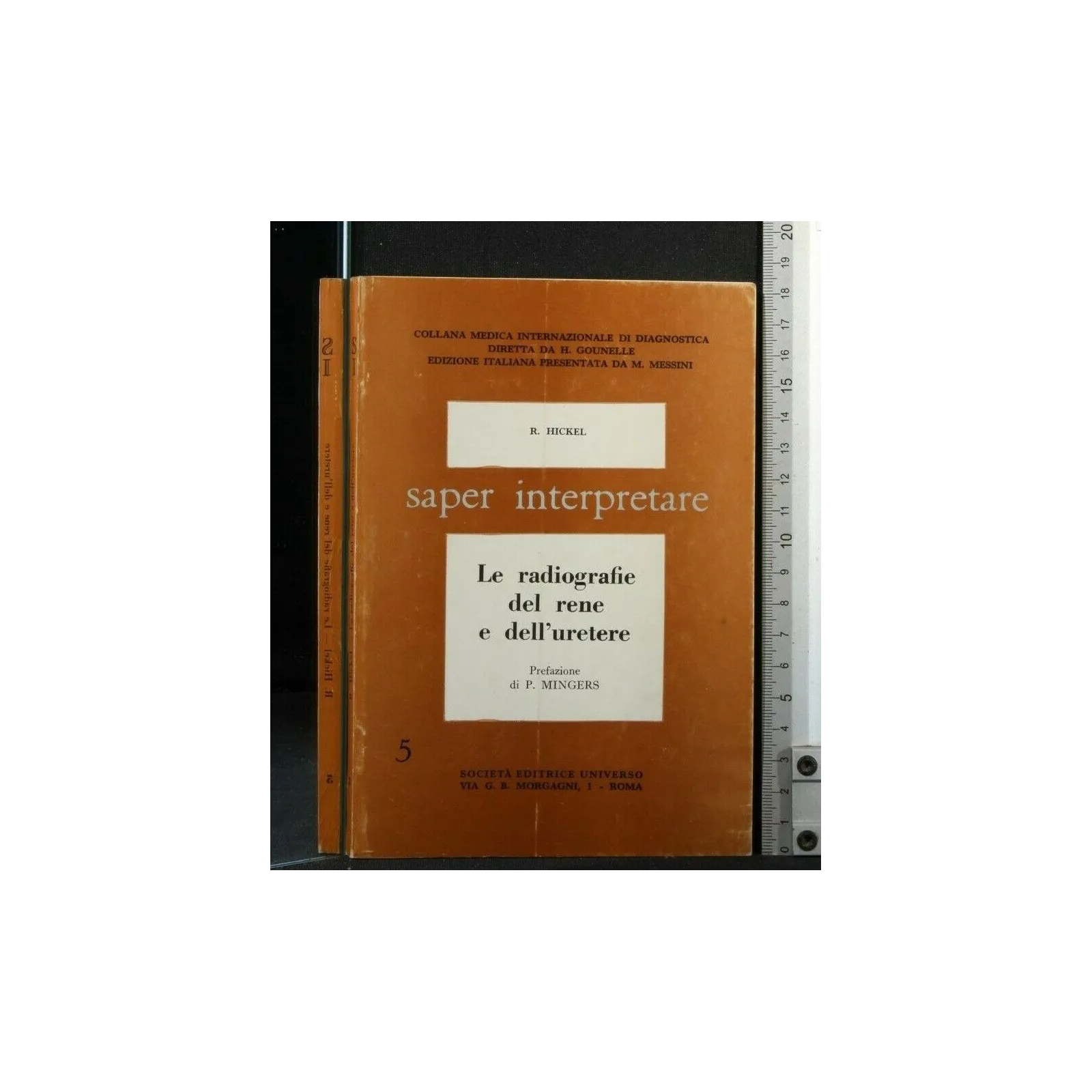 LE RADIOGRAFIE DEL RENE E DELL'URETERE SAPER INTERPRETARE