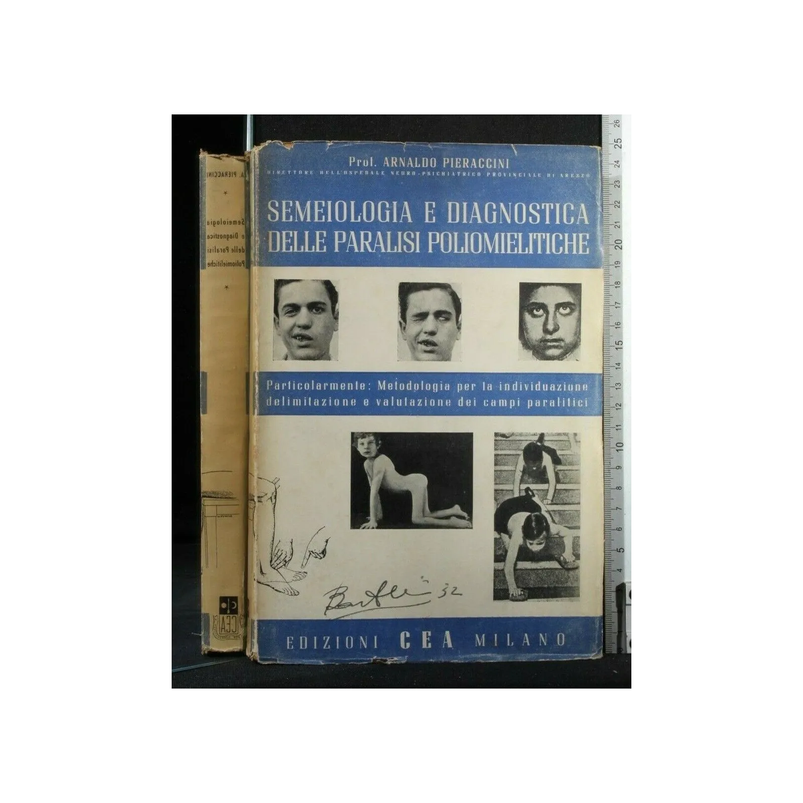 SEMEIOLOGIA E DIAGNOSTICA DELLE PARALISI POLIOMIELITICHE