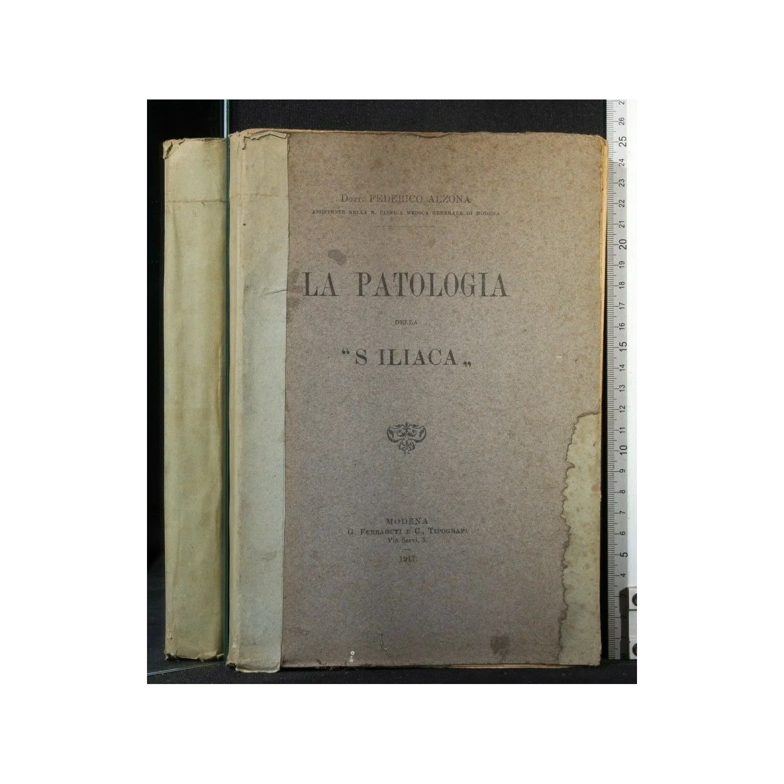 LA PATOLOGIA DELLA "S ILIACA"