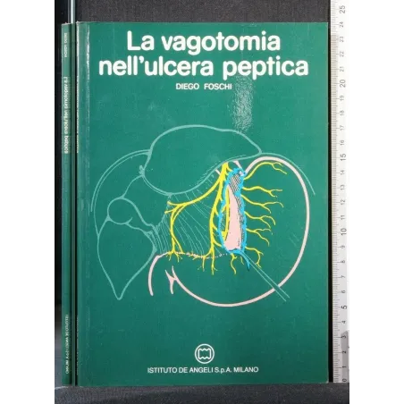 LA VAGOTOMIA NELL'ULCERA PEPTICA