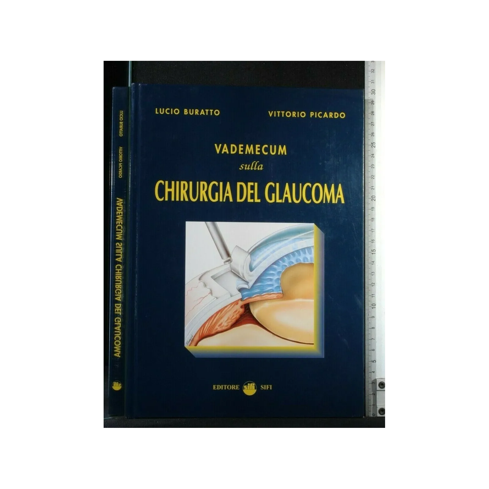 VADEMECUM SULLA CHIRURGIA DEL GLAUCOMA