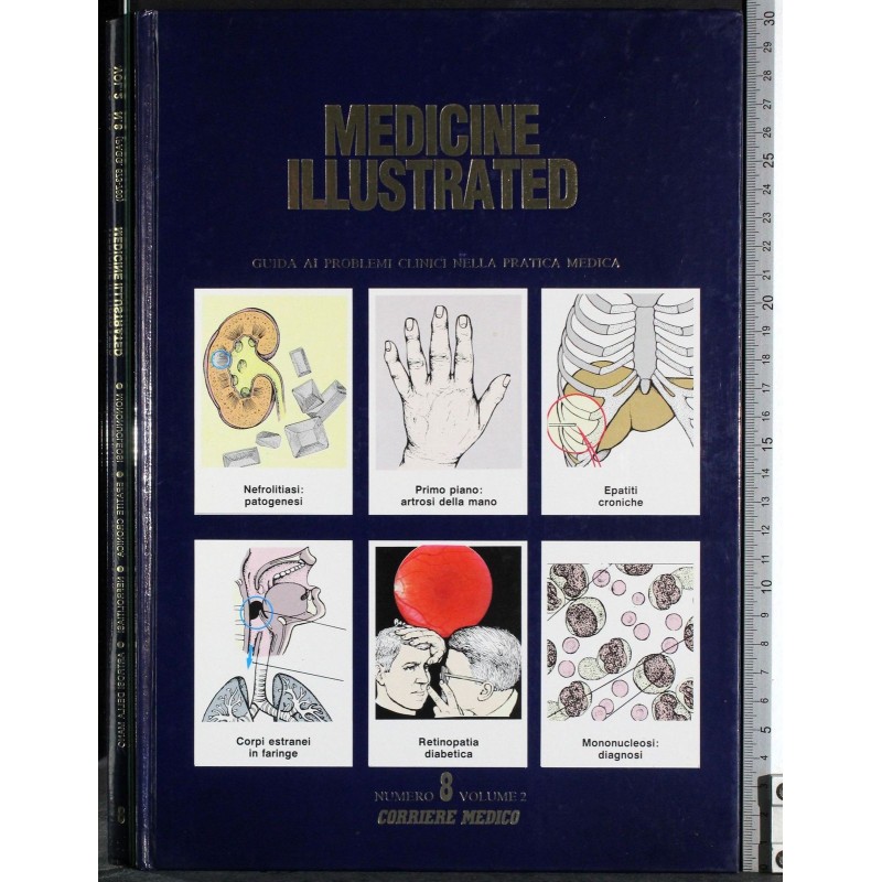MEDICINE ILLUSTRATED-n 8, vol 2-1986