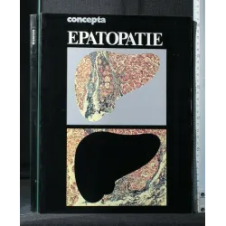 CONCEPTA EPATOPATIE