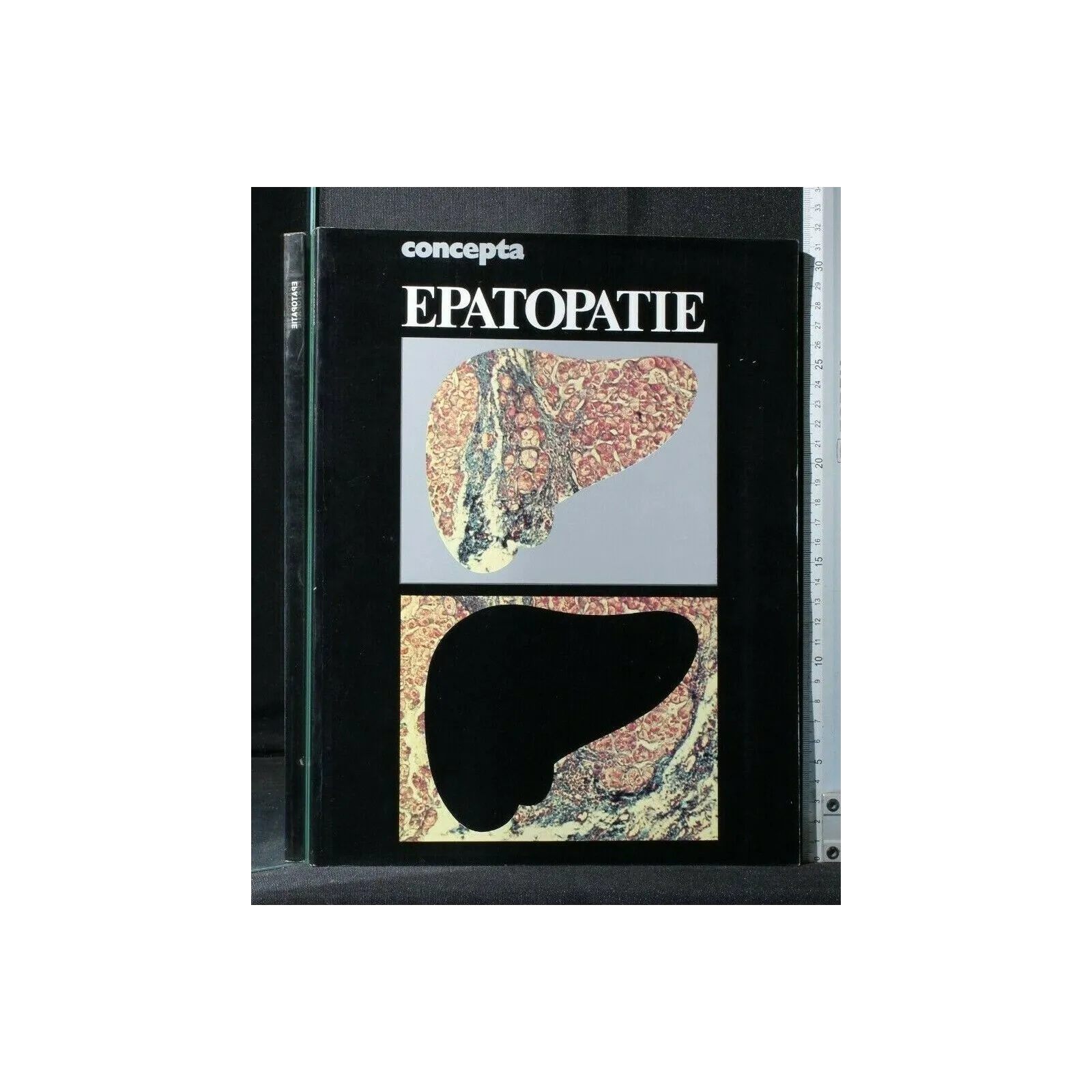 CONCEPTA EPATOPATIE