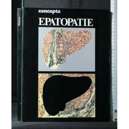 CONCEPTA EPATOPATIE