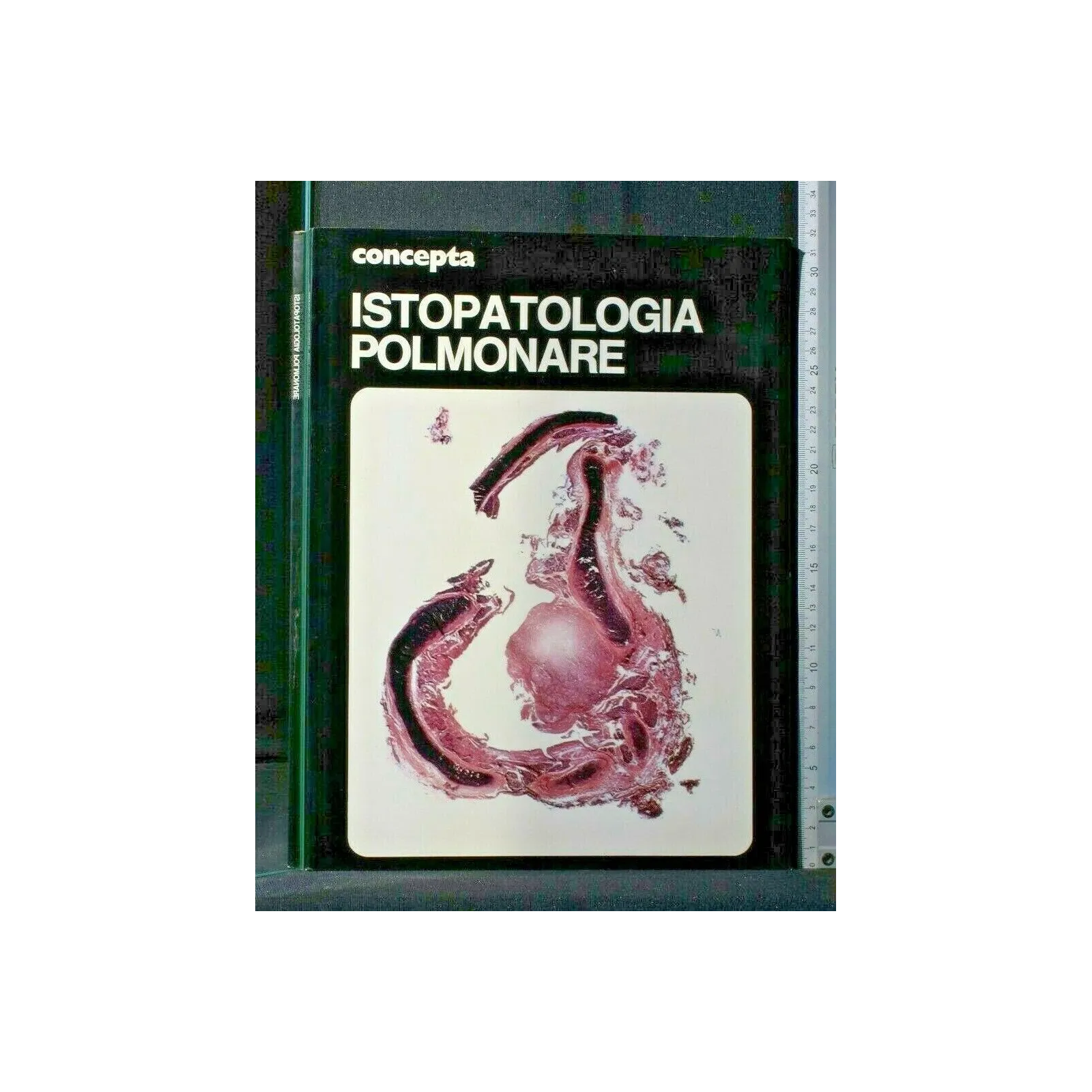 CONCEPTA. ISTOPATOLOGIA POLMONARE