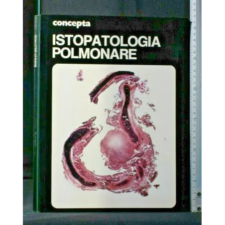 CONCEPTA. ISTOPATOLOGIA POLMONARE
