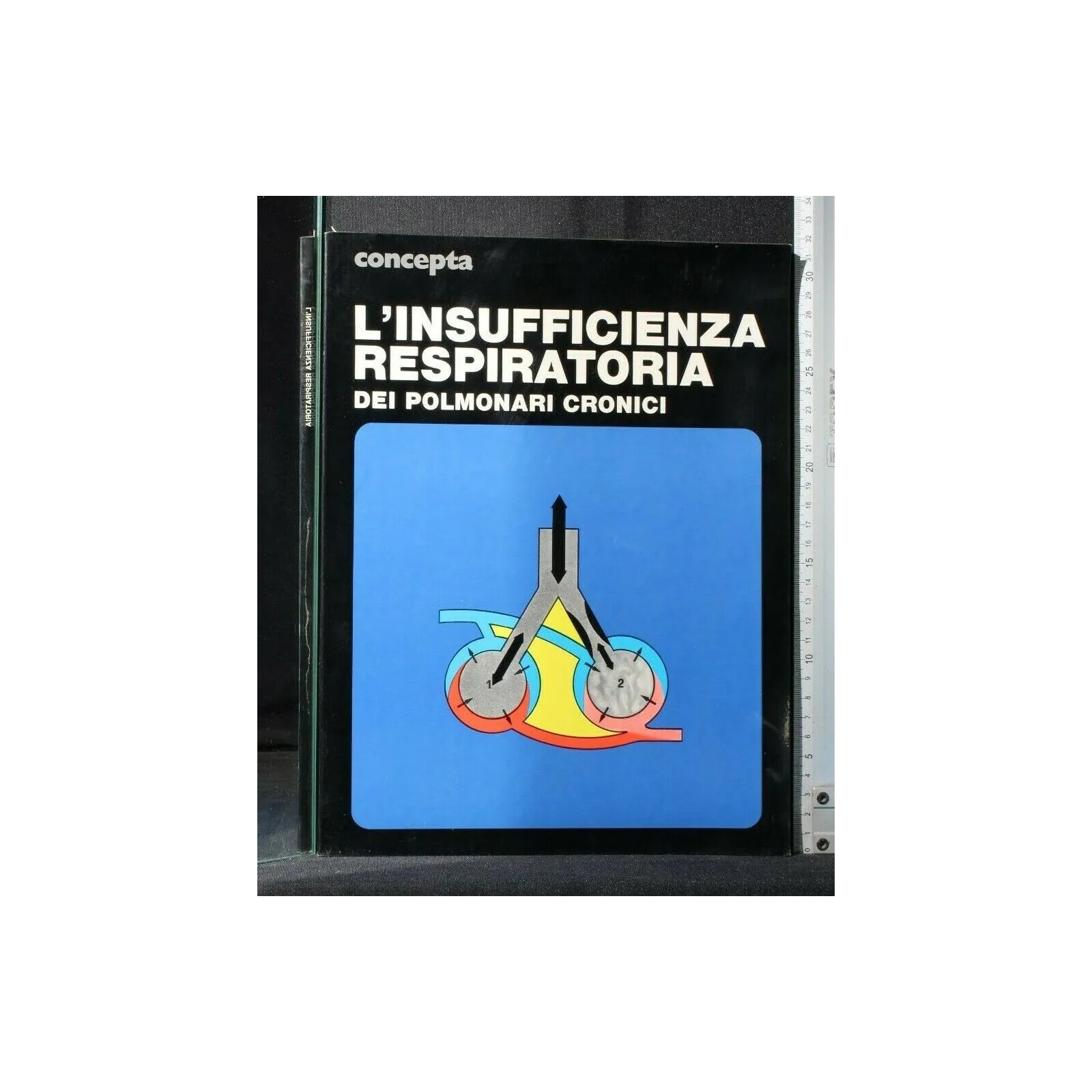 CONCEPTA L'INSUFFICIENZA RESPIRATORIA DEI POLMONI CRONICI