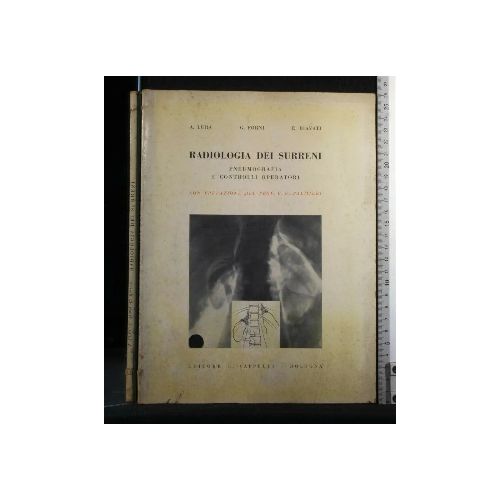RADIOLOGIA DEI SURRENI PNEUMOGRAFIA E CONTROLLI OPERATORI
