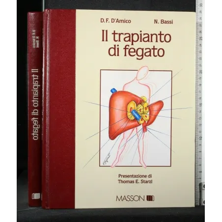 IL TRAPIANTO DI FEGATO