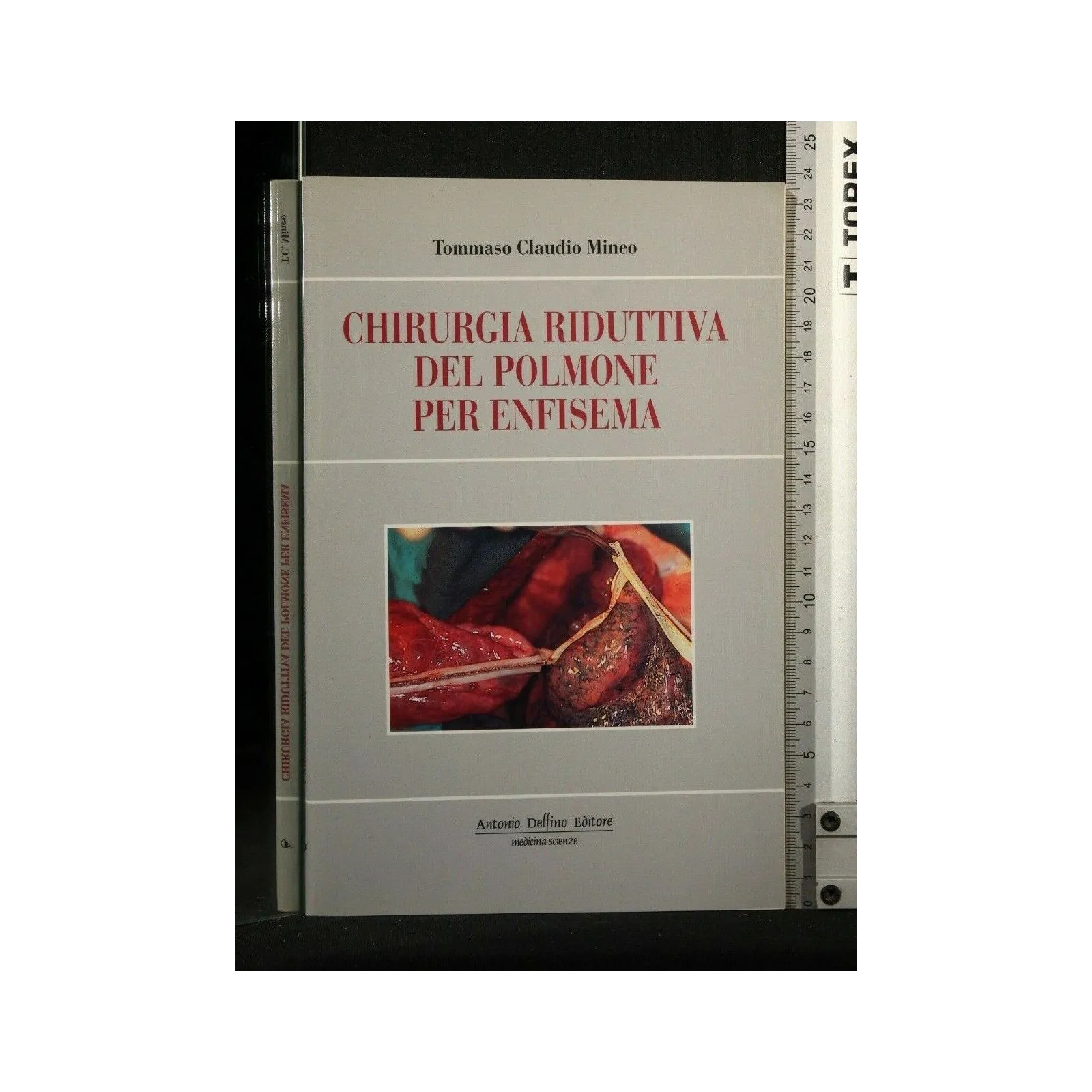 CHIRURGIA RIDUTTIVA DEL POLMONE PER ENFISEMA