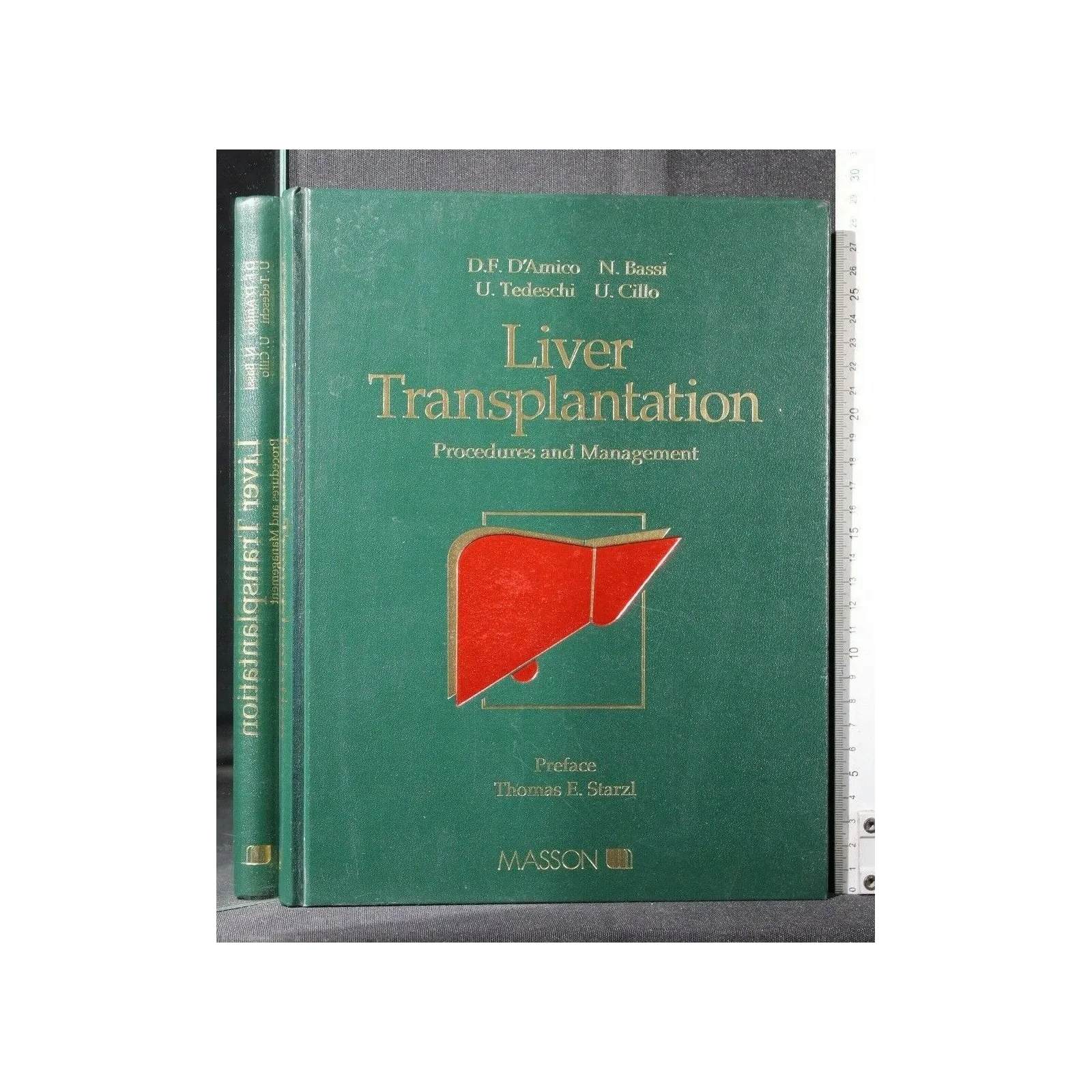 LIVER TRANSPLANTATION PROCEDURES AND MANAGEMENT