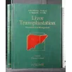 LIVER TRANSPLANTATION PROCEDURES AND MANAGEMENT