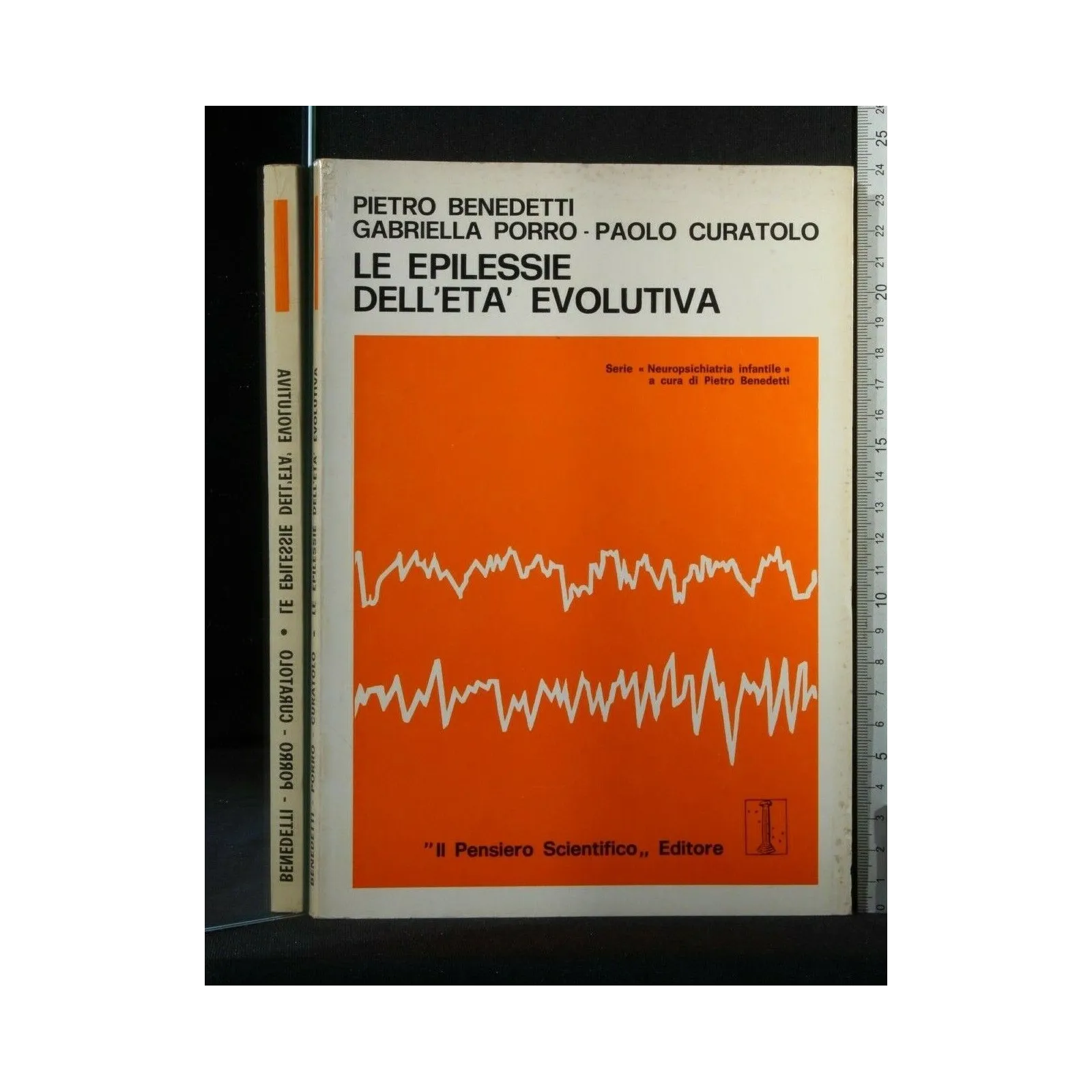 LE EPILESSIE DELL'ETA' EVOLUTIVA