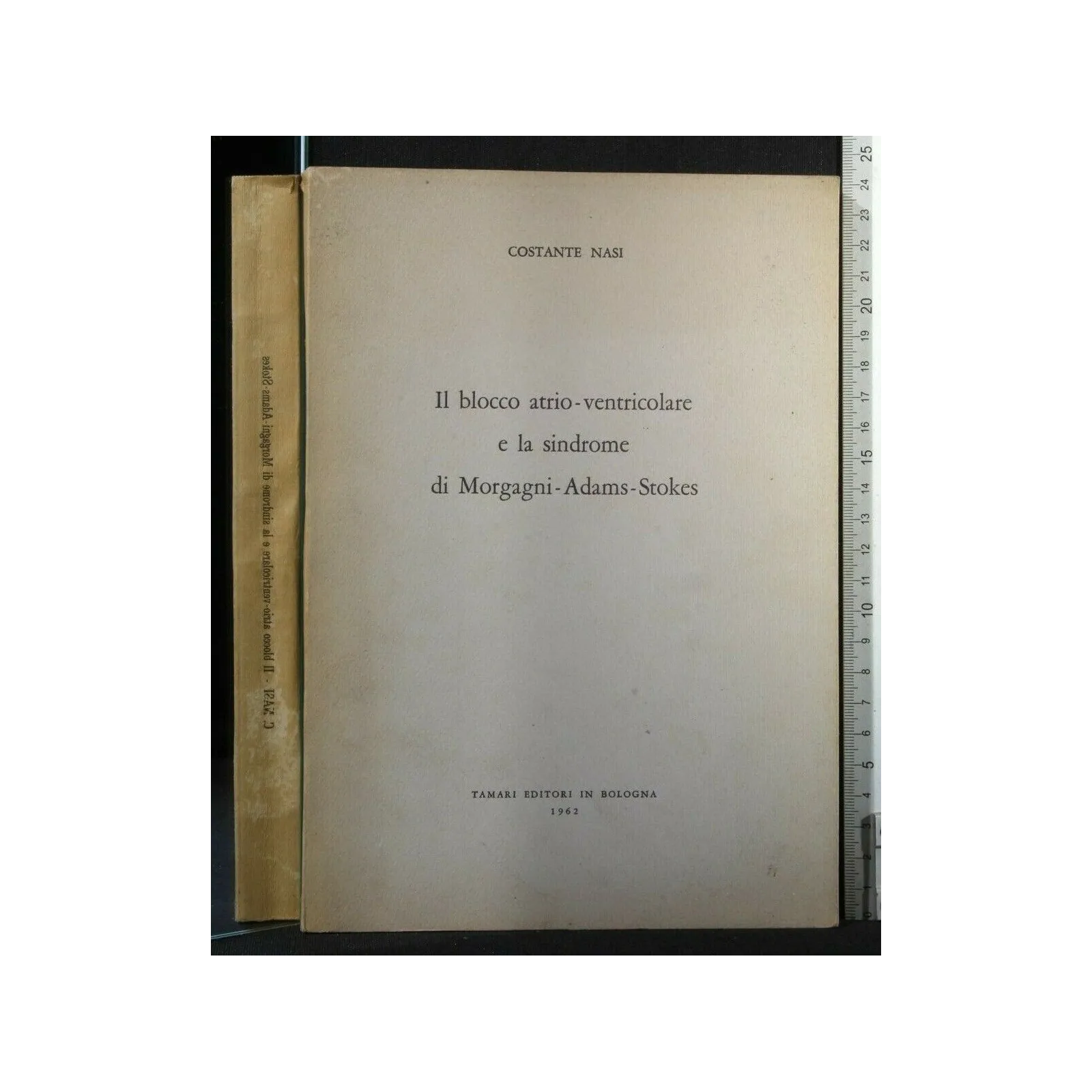 IL BLOCCO ATRIO-VENTRICOLARE E LA SINDROME DI