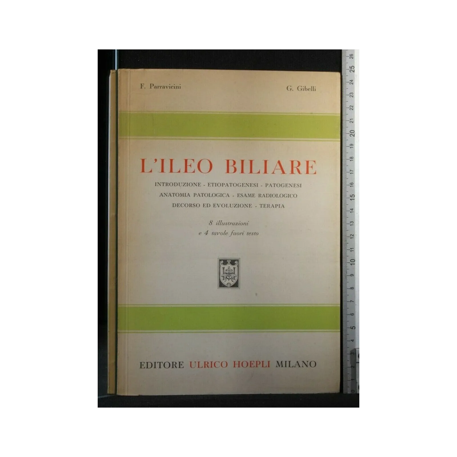 L'ILEO BILIARE