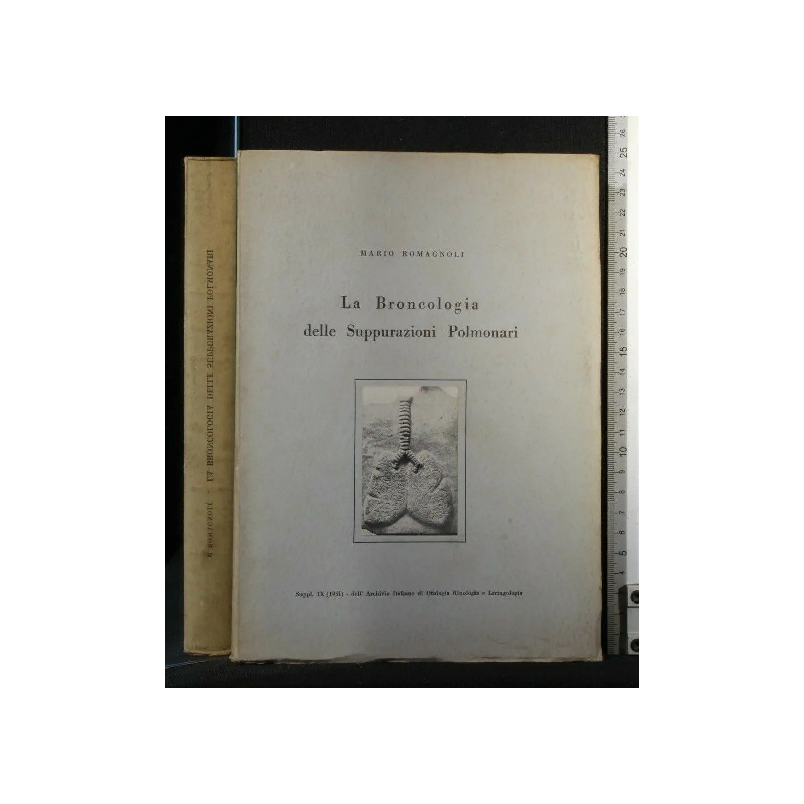 LA BRONCOLOGIA DELLE SUPPURAZIONI POLMONARI SUPPL. IX (1951)