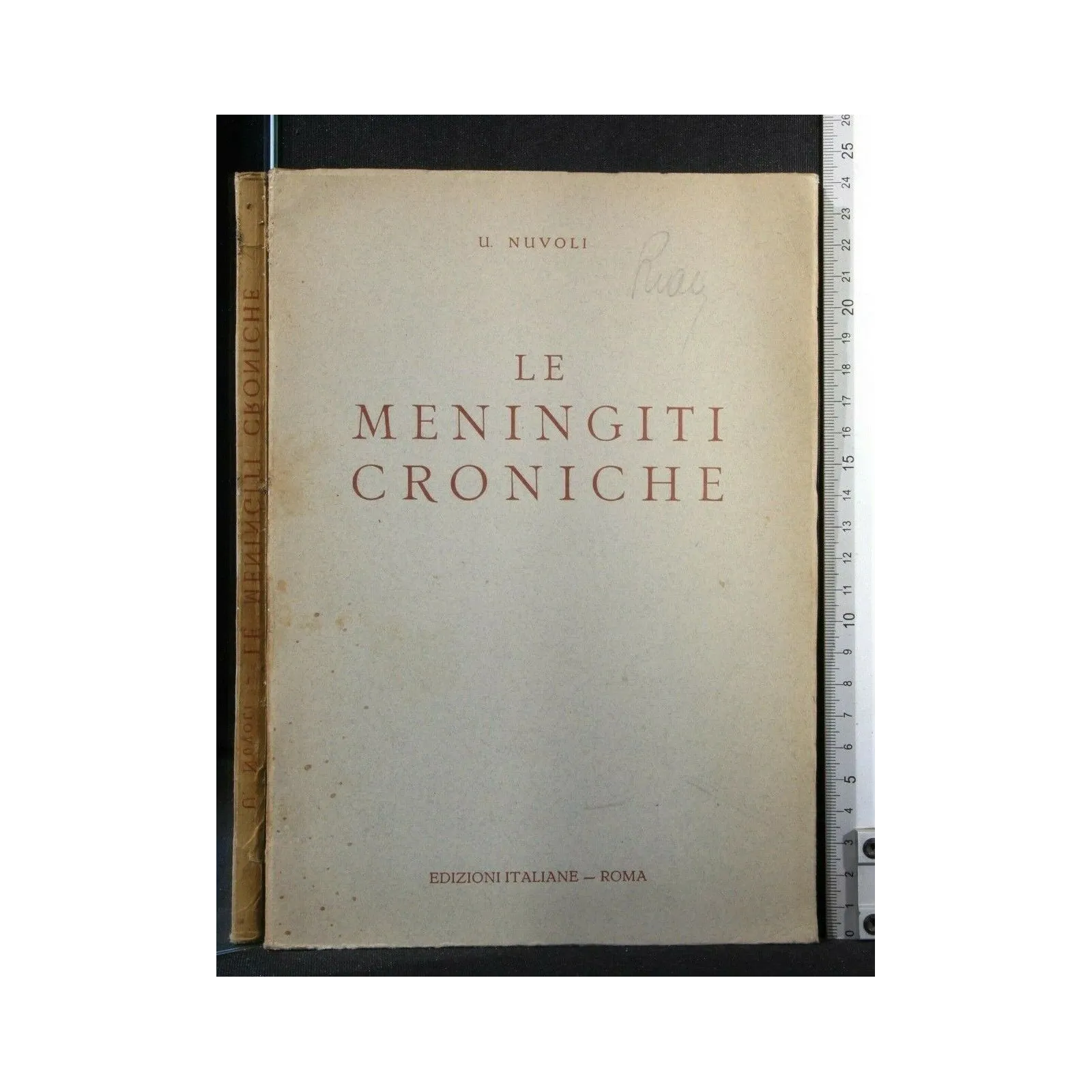 LE MENINGITI CRONICHE