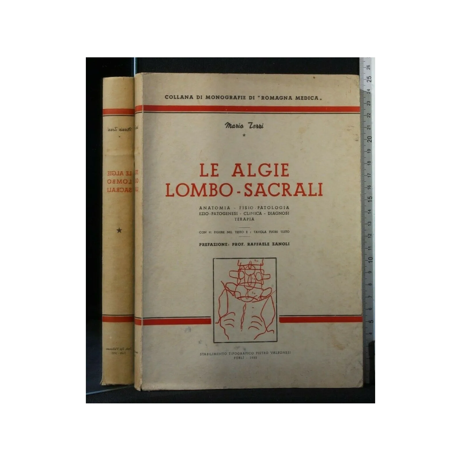 LE ALGIE LOMBO-SACRALI