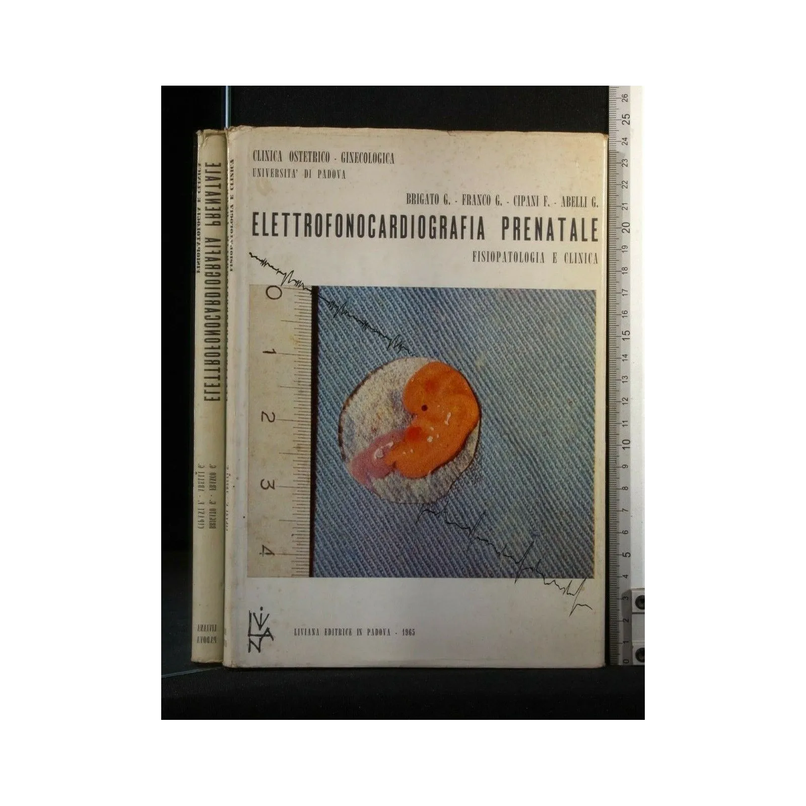 ELETTROFONOCARDIOGRAFIA PRENATALE FISIOPATOLOGIA E CLINICA